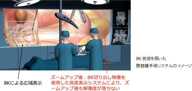 fig02_8K技術を用いた腹腔鏡手術システムのイメージ