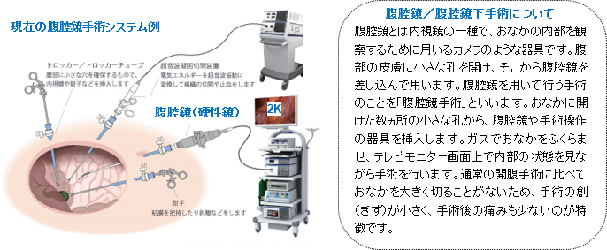 fig03_現在の腹腔鏡手術システム例